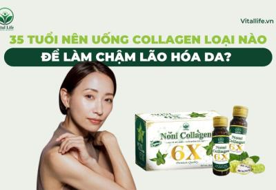 35 tuổi nên uống collagen loại nào để làm chậm lão hóa da?