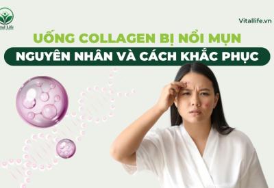 Uống Collagen Bị Nổi Mụn: Nguyên Nhân Và Cách Khắc Phục