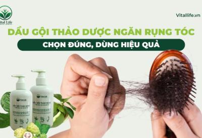 Dầu Gội Thảo Dược Ngăn Rụng Tóc: Chọn Đúng, Dùng Hiệu Quả