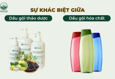Sự Khác Biệt Giữa Dầu Gội Thảo Dược Và Dầu Gội Hóa Chất
