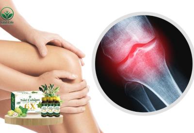 Tác dụng Collagen với Xương Khớp & Cách Bổ Sung Hiệu Quả