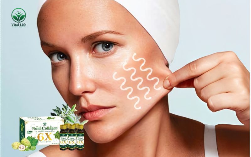 Da bị kém đàn hồi do thiếu Collagen