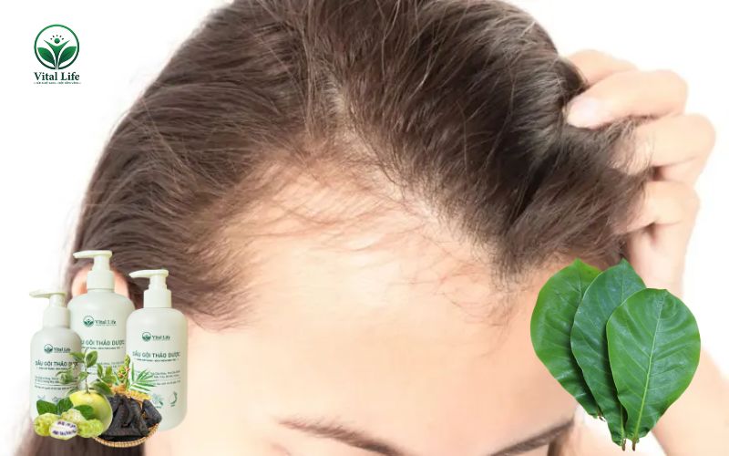 Lá Bàng Hỗ trợ giảm rụng tóc và kích thích nang tóc phát triển khỏe mạnh