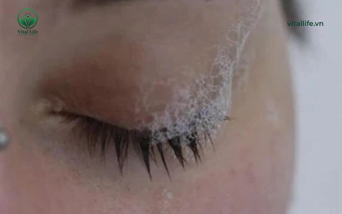 Hướng dẫn xử lý khi bị dầu gội vào mắt