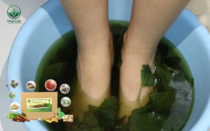 Bài thuốc ngâm chân với lá lốt