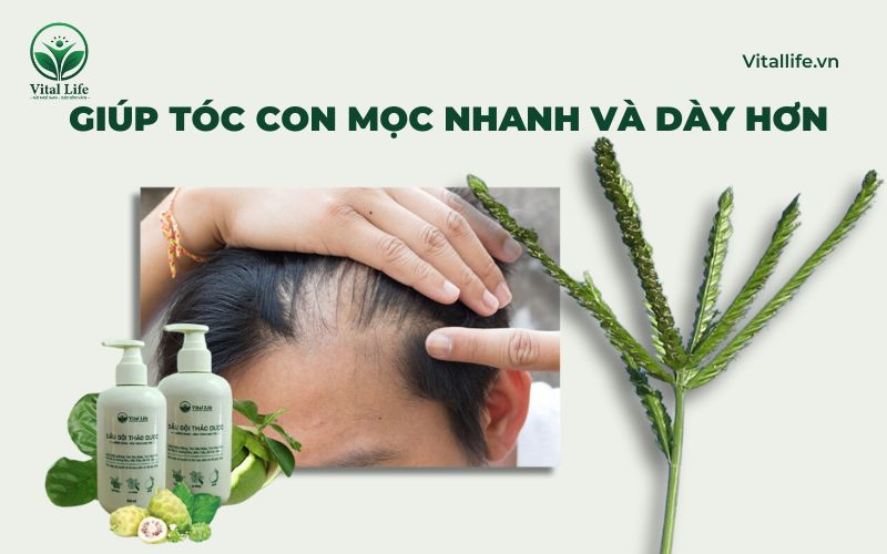 Cỏ mần trầu kích thích nang tóc phát triển, giúp tóc con mọc nhanh và dày hơn