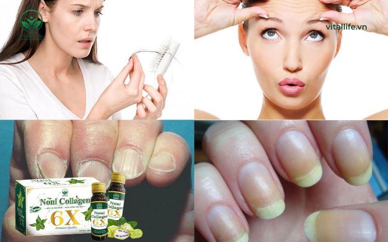 Liều lượng Collagen mỗi ngày để cải thiện sức khỏe làn da, tóc và móng