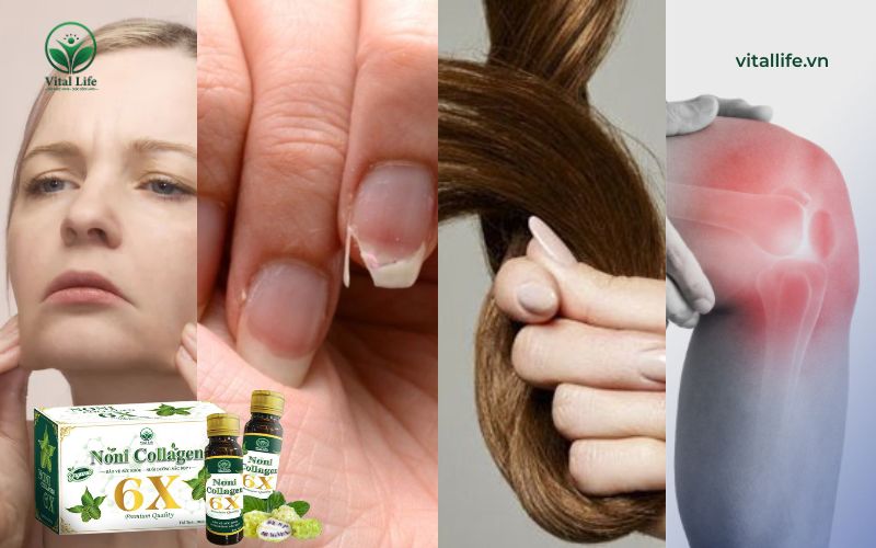Các dấu hiệu suy giảm collagen