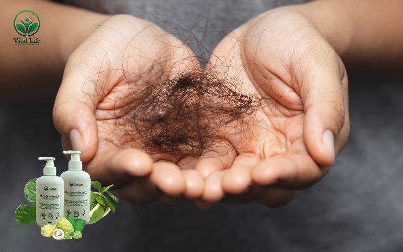 Tiêu chí để lựa chọn dầu gội thảo dược ngăn rụng tóc ưng ý và hiệu quả