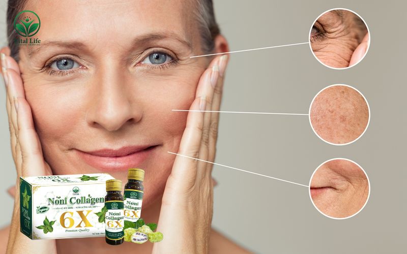 Dấu hiệu lâm sàng của việc thiếu hụt collagen và elastin